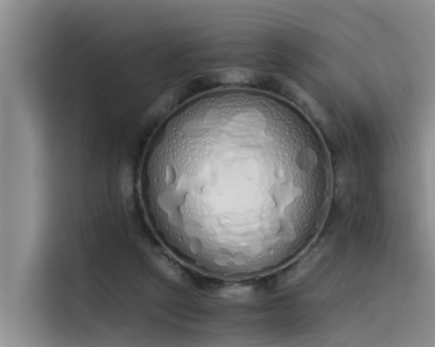 X0000115620257200911171321