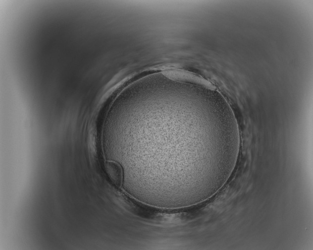 X0000115620295200911171321