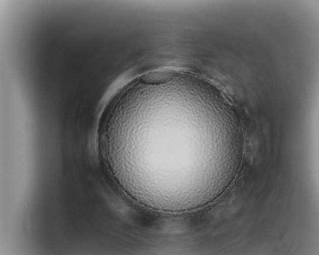 X0000115620296200911171321