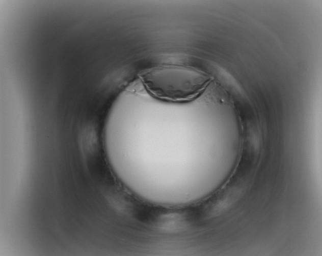 X0000115620312200911171321