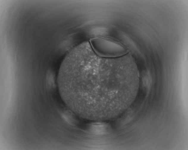 X0000115620316200911171321