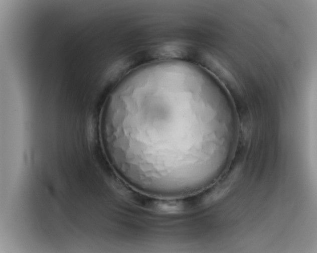 X0000115620359200911171320