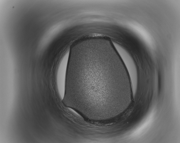 X0000115620387200911171320