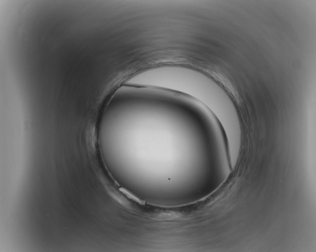 X0000115620397200911171320