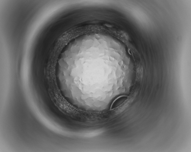 X0000115620765200911171316