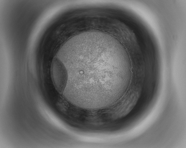 X0000115620766200911171316