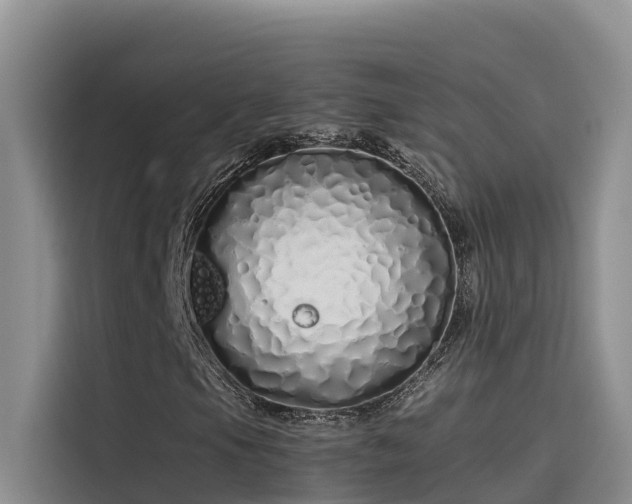 X0000115621105200911171310