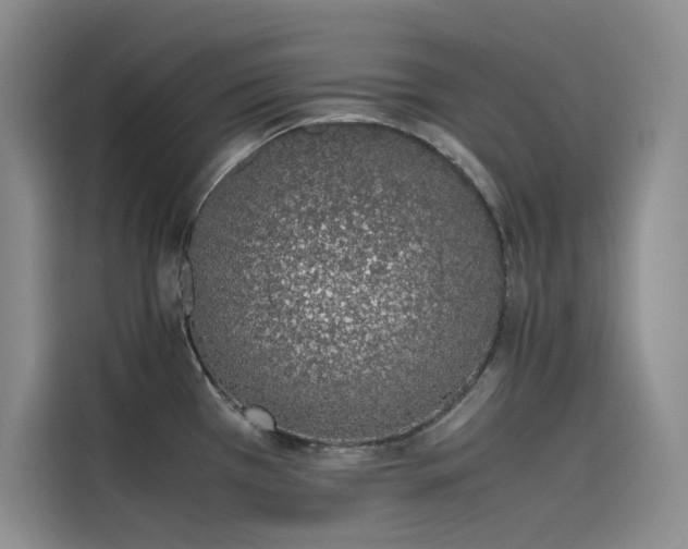 X0000115621385200911171307