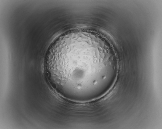 X0000115621409200911171306