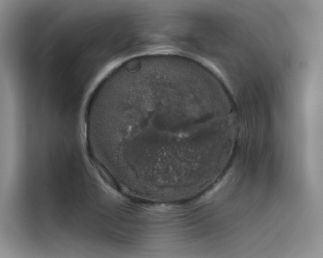 X0000115621414200911171307