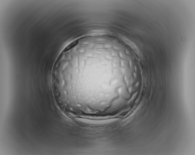 X0000115621473200911171306