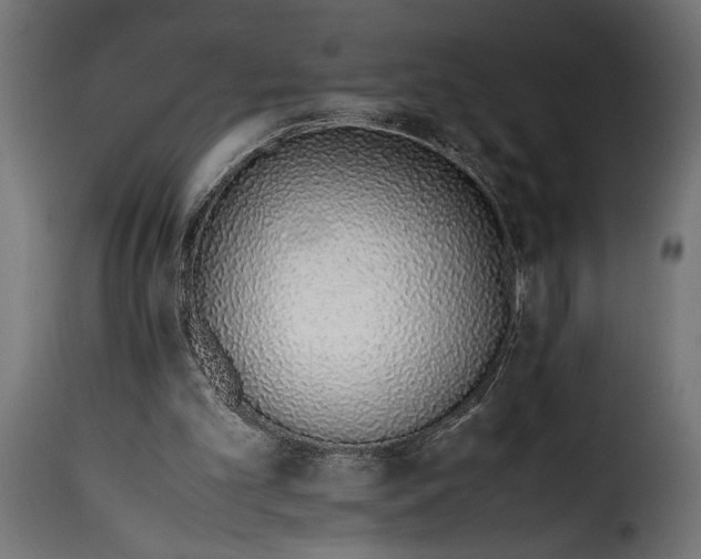 X0000115620101200911241633