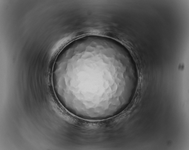 X0000115620149200911241632