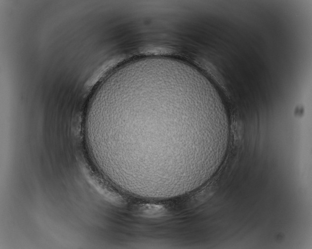 X0000115620159200911241632