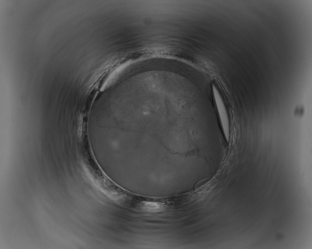 X0000115620167200911241632