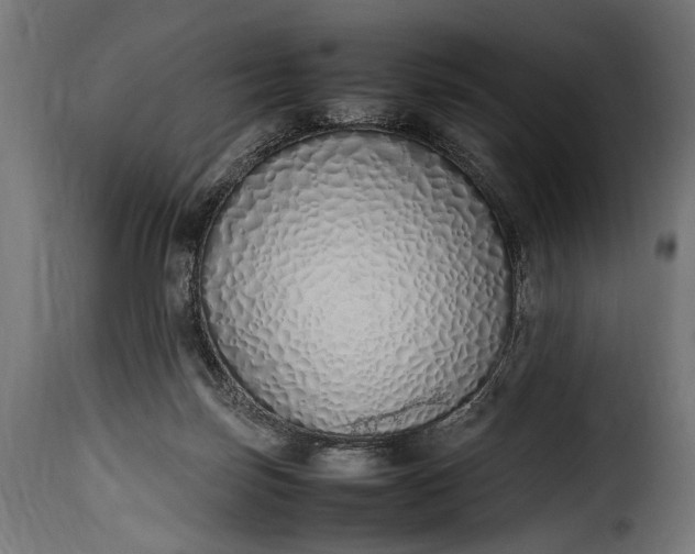 X0000115620171200911241632