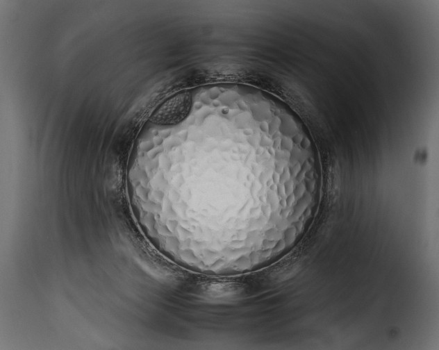 X0000115620173200911241632