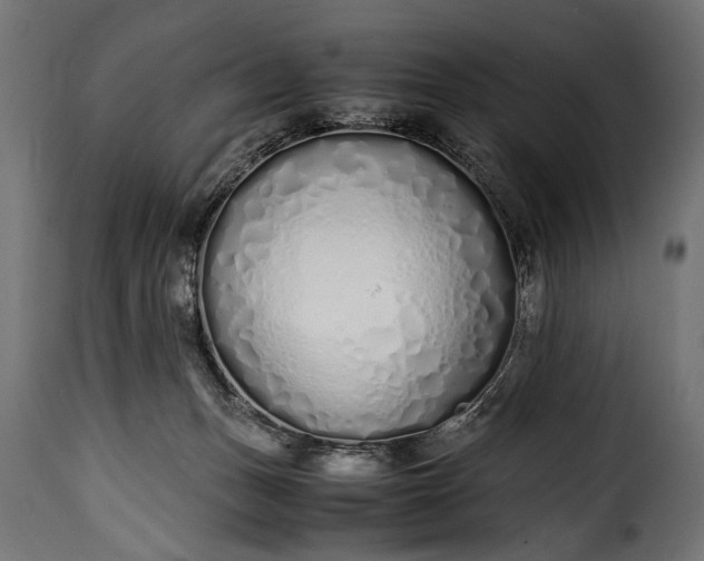 X0000115620175200911241632