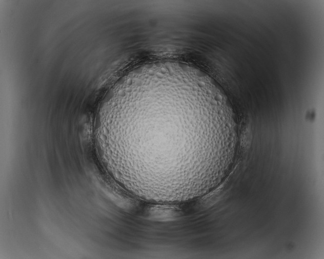 X0000115620179200911241632