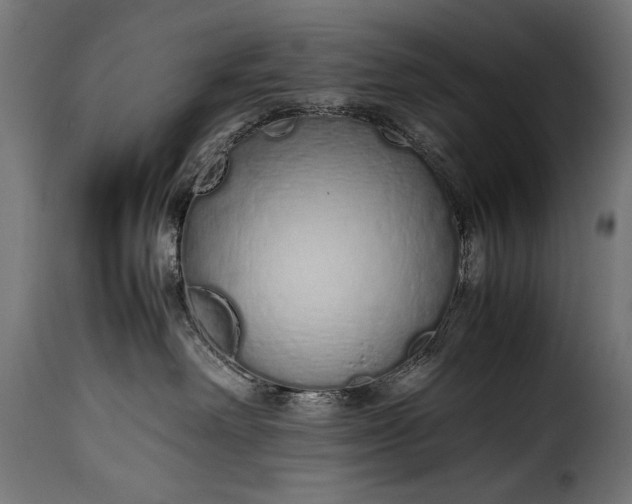 X0000115620238200911241631