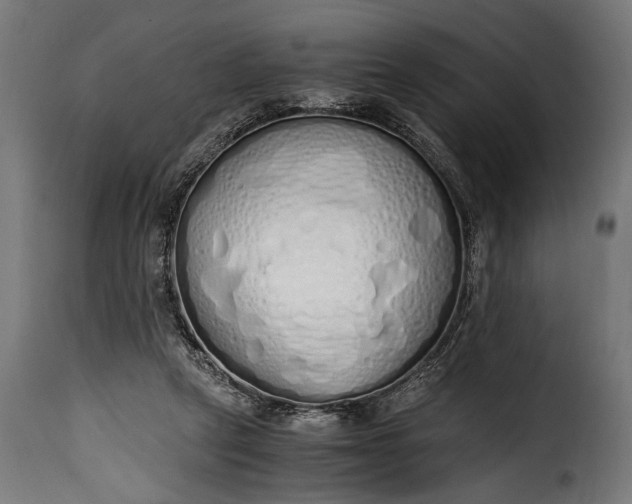 X0000115620257200911241630