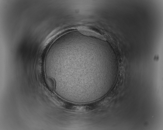 X0000115620295200911241630