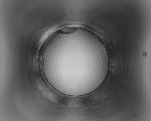 X0000115620296200911241630