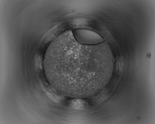 X0000115620316200911241630