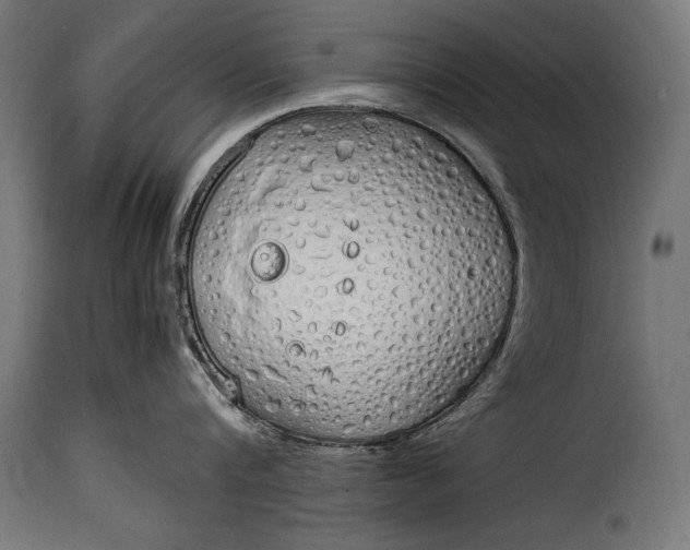 X0000115620816200911241622