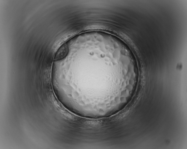 X0000115620937200911241620