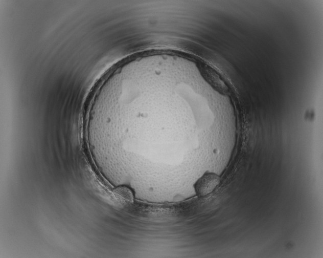 X0000115621076200911241618