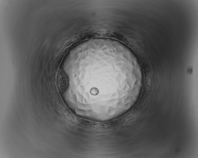 X0000115621105200911241617