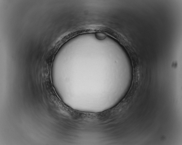 X0000115621158200911241617