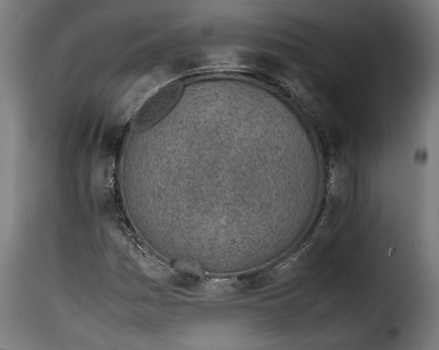 X0000115621161200911241617