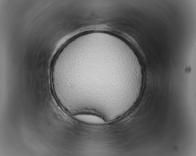 X0000115621176200911241617