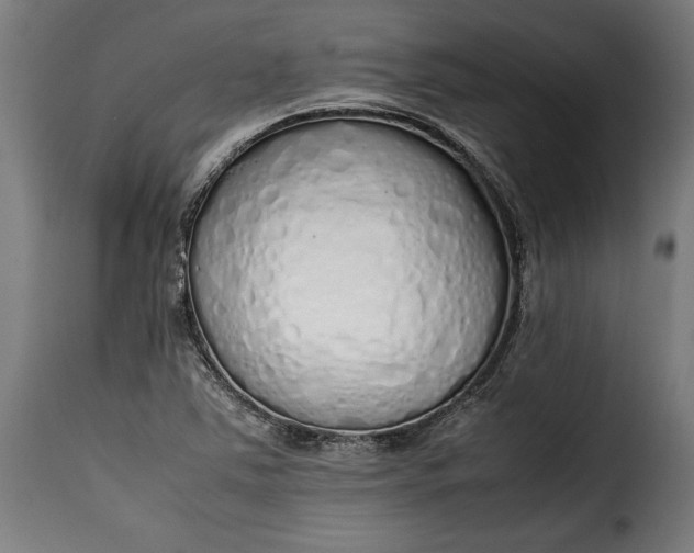 X0000115621363200911241614