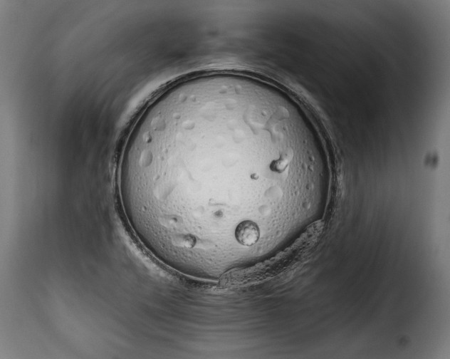 X0000115621416200911241613