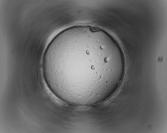 X0000115621440200911241614