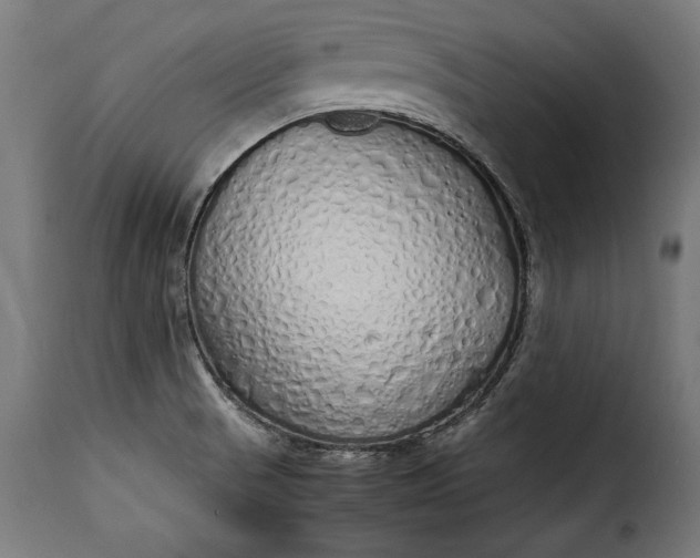 X0000115621521200911241612