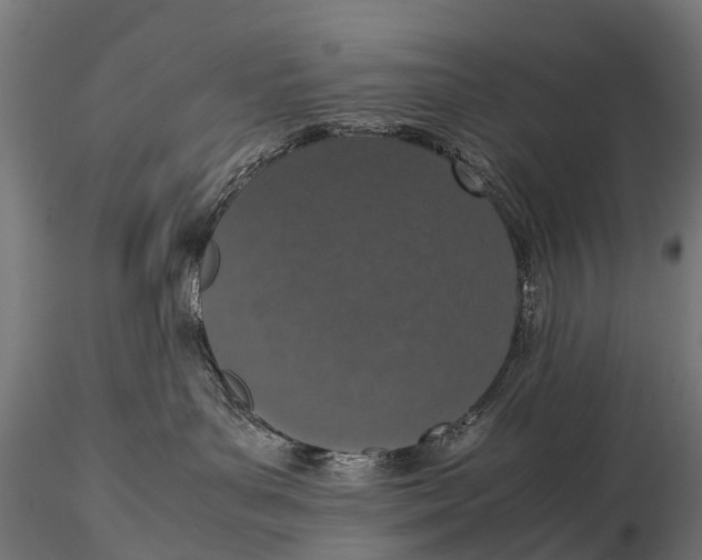 X0000115620143200912011623