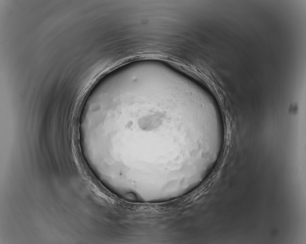 X0000115620145200912011622