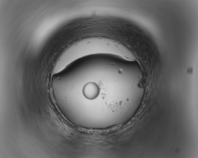 X0000115620146200912011622