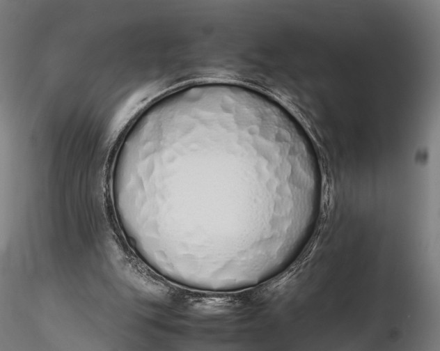 X0000115620151200912011622