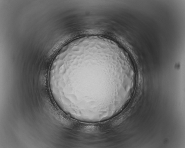 X0000115620153200912011622