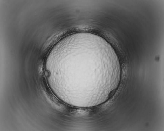 X0000115620166200912011623