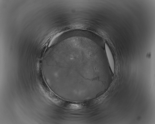 X0000115620167200912011623