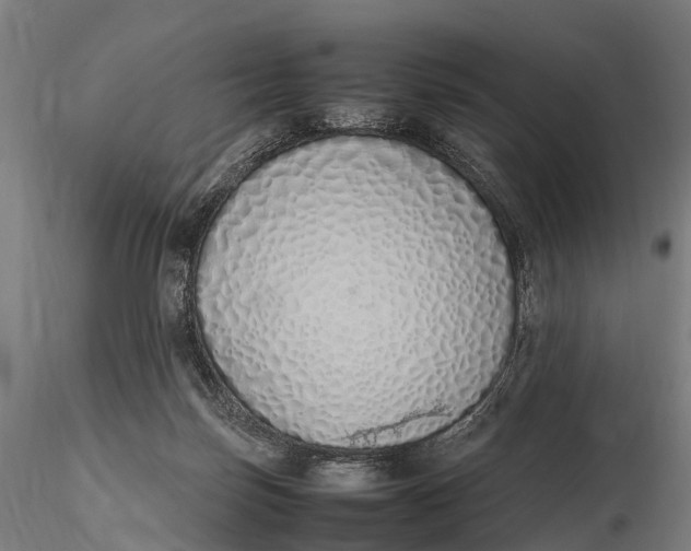 X0000115620171200912011623