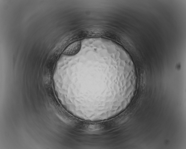 X0000115620173200912011623