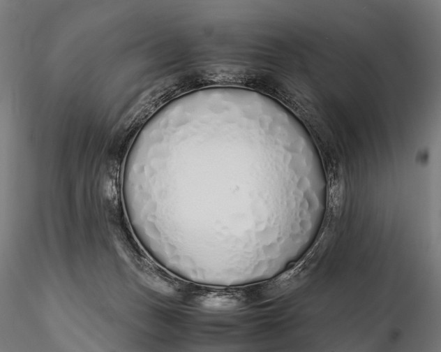 X0000115620175200912011623