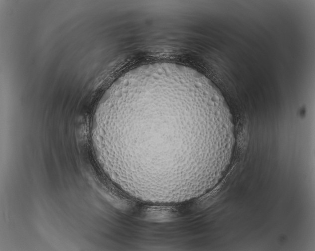 X0000115620179200912011623